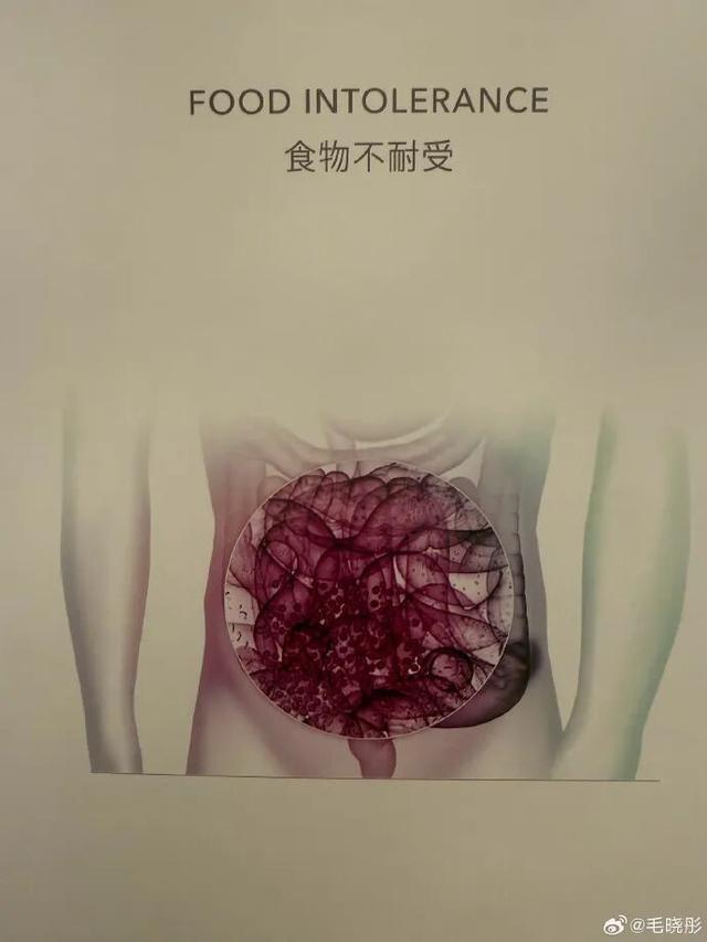 开云体育官方网站-演员毛晓彤凌晨从医美诊所离开引网友热议,其晒医院检测报告回应:作为一个从小爱吃面食的天津人,查出面粉不耐受可怎么办